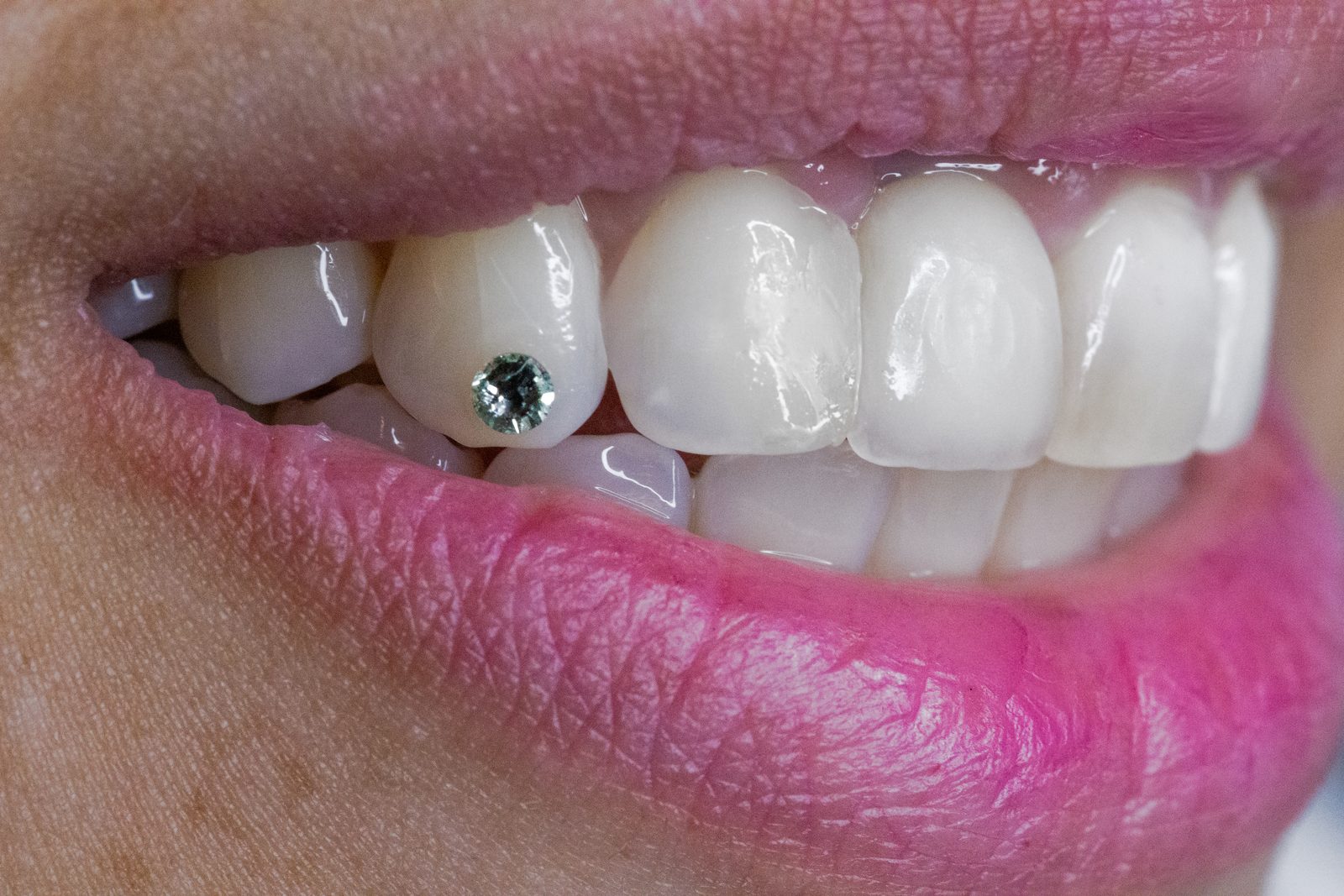 Tooth Gem Teal