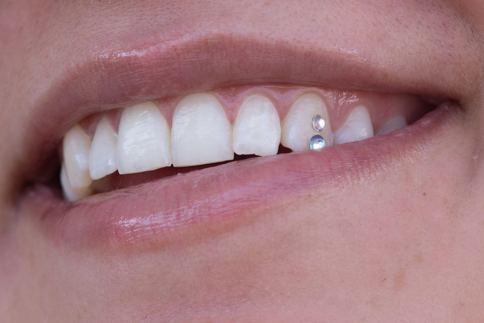 Tooth Gems Double